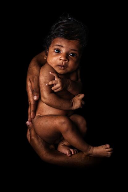 Ayedatujannah Tahiat. Bangladés. <p>Tiene apenas 29 días y esta imagen la retrata junto con su madre, Jannatul Ferdousi, de 22 años, en las Unidades de Cuidado Especial para Recién Nacidos del Instituto de Salud Infantil y Materna en Daca, Bangladés, el 18 de febrero de 2018.</p> <p>Ayedatujannah nació prematura, a los ocho meses de gestación. No lloró en la sala de parto: convulsionó y se puso azul. Logró sobrevivir gracias a la ayuda médica que recibió en los primeros cuatro días de vida y a la lactancia materna. Su nombre significa ‘la que regresó del cielo’. "No estábamos seguros de si iba a vivir o morir. Entonces, cuando sobrevivió, fue como si regresara del cielo”, cuenta su progenitora. “No pudo tocar a mi bebé por más de siete días, no era seguro para ella. Pero después el médico me enseñó a amamantarla y ella se enganchó de inmediato. La lactancia materna fue lo mejor, lo hago 10 veces por día".</p>