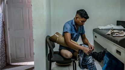Migrants maimed by ‘The Beast’: Riding the rails in search of a new life 