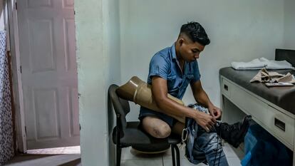 Migrants maimed by ‘The Beast’: Riding the rails in search of a new life