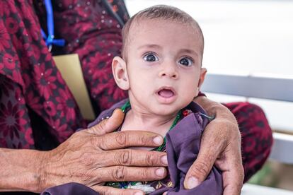El 95% de los hogares en Afganistán no consumen suficientes alimentos, los adultos comen menos y se saltan las comidas para que sus hijos puedan comer más, según varias encuestas realizadas por el PMA. En el Centro de Alimentación Terapéutica para Pacientes Internos apoyado por Unicef en el Hospital Regional de Herat, Javid, de 15 meses, que sufre desnutrición aguda severa con complicaciones, recibe alimentos terapéuticos y atención médica.