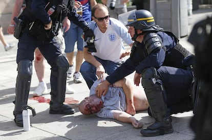 Un hombre, herido en los enfrentamientos entre hinchas es atendido por la policía francesa.