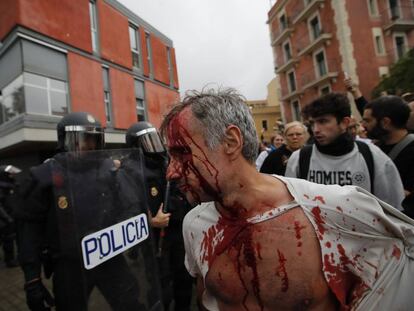 Un hombre herido en la intervención de la Policía Nacional en la Escuela Mediterránea de Barcelona, en la jornada del referéndum independentista catalán del 1-O.