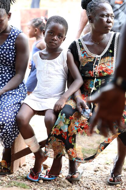 Una niña acaba de recibir las curas en una de las úlceras provocadas por el pian, en Nyanney Camp, Ghana.