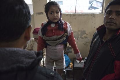 Nandini espera en silencio a que le quiten los vendajes para dejar al aire las quemaduras que se hizo al caer en un barreño con agua hirviendo.