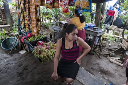 María Ester Carrillo, de 16 años, fue infectada por el virus del zika durante sexta semana de embarazo, en la aldea Pueblo Nuevo, en el sur de Guatemala. 