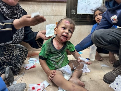Un niño palestino herido recibe atención médica en el hospital Al Aqsa, en la ciudad de Deir el Balah, después de un bombardeo israelí, el 8 de junio de 2024