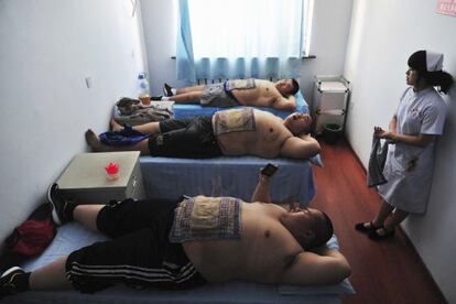 La lucha contra la obesidad es una preocupación en muchos países, incluso con métodos inverosímiles, como el del trapo sobre el estómago en China.