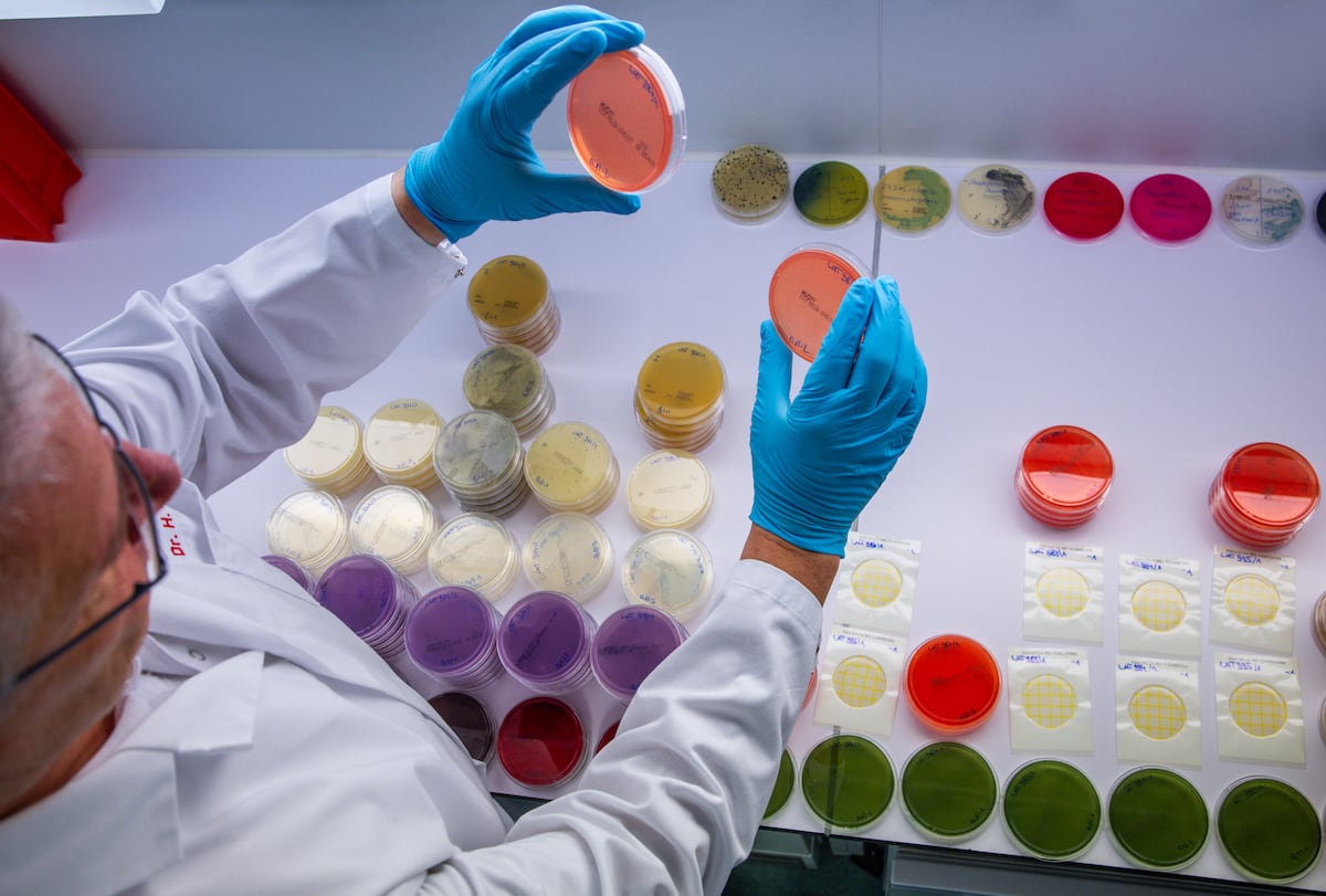 Cuando tu cuerpo se convierte en una cervecería: un estudio desvela los misterios del síndrome de autofermentación