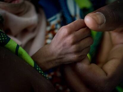 Hadida, de cinco meses y con malnutrición aguda severa agarra el dedo de su madre, Fátima, en el hospital de Diffa, en Níger.