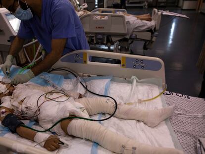 Un médico trata a una niña gravemente herida, el pasado día 13 en la UCI de un hospital de la ciudad de Gaza.