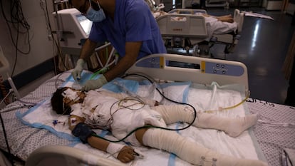 Un médico trata a una niña gravemente herida, el pasado día 13 en la UCI de un hospital de la ciudad de Gaza.