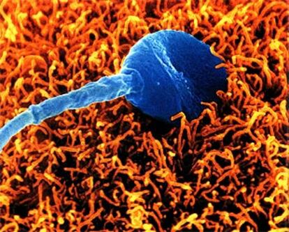 Un espermatozoide humano intentando fecundar un óvulo.