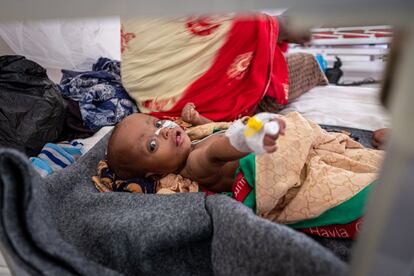 Abshir Abdulahi (tres meses) en su cama en el centro de estabilización de Kismayo. El niño sufre de desnutrición aguda y es tratado para su recuperación.