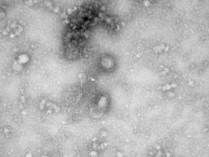 Una imagen al microscopio electrónico del primer caso aislado de coronavirus, el 27 de enero de 2020. La imagen fue difundida por GISAID.