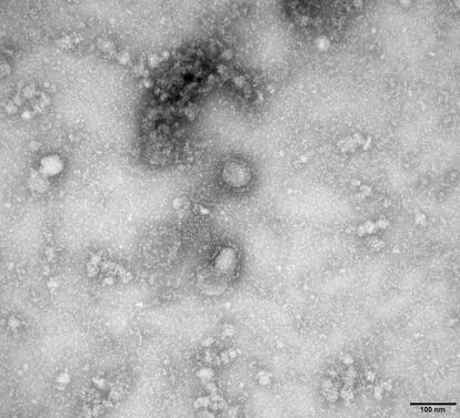 Imagen al microscopio del primer caso aislado de este coronavirus, en enero de 2020.