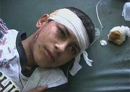 Un niño iraquí, que viajaba en uno de los dos autobuses escolares destrozados, tumbado en un hospital de Basora.