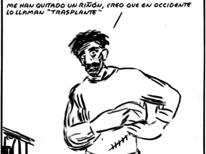 EL ROTO