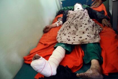Una mujer herida, víctima de una explosión, yace en un hospital de la provincia afgana de Herat.