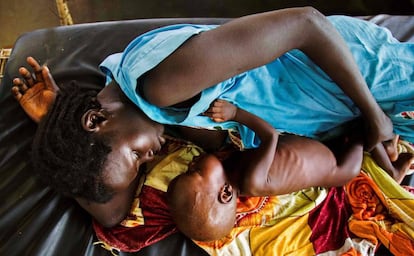 Una madre da de comer a un ni&ntilde;o con malnutrici&oacute;n aguda en Aweil (Sud&aacute;n del Sur). 