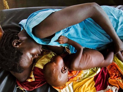 Una madre da de comer a un ni&ntilde;o con malnutrici&oacute;n aguda en Aweil (Sud&aacute;n del Sur). 