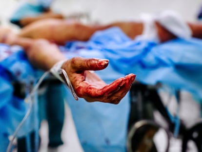 Un pandillero herido de bala, durante la operación que le salvó la vida en un hospital de San Salvador, en 2015.