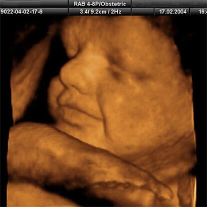 El documental capta el momento, en el tercer trimestre de embarazo, en el que el feto comienza a abrir los ojos.