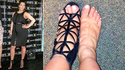 Durante su primer embarazo, Kim Kardashian sufrió los estragos de pies hinchados + sandalias de tiras. La propia Kardashian subió la foto a su Instagram tras el evento bromeando: “¿Hinchazón de pies o un nuevo tatuaje Givenchy?”.