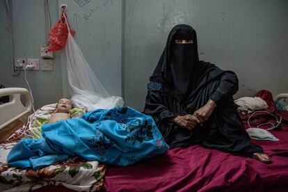 La abuela de Mona Basam Abdalá (seis meses) acompaña a la pequeña que es tratada de desnutrición severa en el hospital público de Ataq (capital de la provincia yemení de Shabwa).