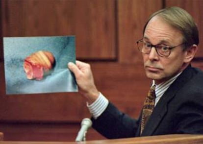 El doctor Jim Sehn sostiene una foto del pene cercenado de John Wayne Bobbitt durante el segundo día del juicio a Lorena Bobbitt.