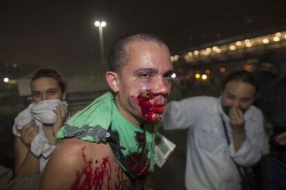 A demonstrator is seen with a foreign object in his face during clashes with riot police in a protest against bus fare price hikes June 20, 2013 in Rio de Janeiro, Brazil. 