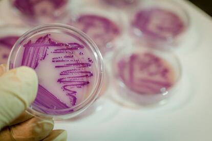 La 'Escherichia coli' (imagen de un cultivo) es una de las bacterias que más resistencia a antibióticos ha desarrollado.