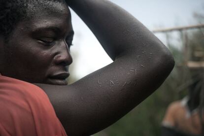 Pescador refugiado em Mobaye mostra as cicatrizes deixadas pelos rituais dos Anti-balaka na ilha Longo, no distrito de Damara, em 28 de fevereiro de 2018. A República Centro-Africana, com 4,6 milhões de habitantes, é o último país do Índice de Desenvolvimento Humano da ONU, isto é, o mais pobre do mundo.