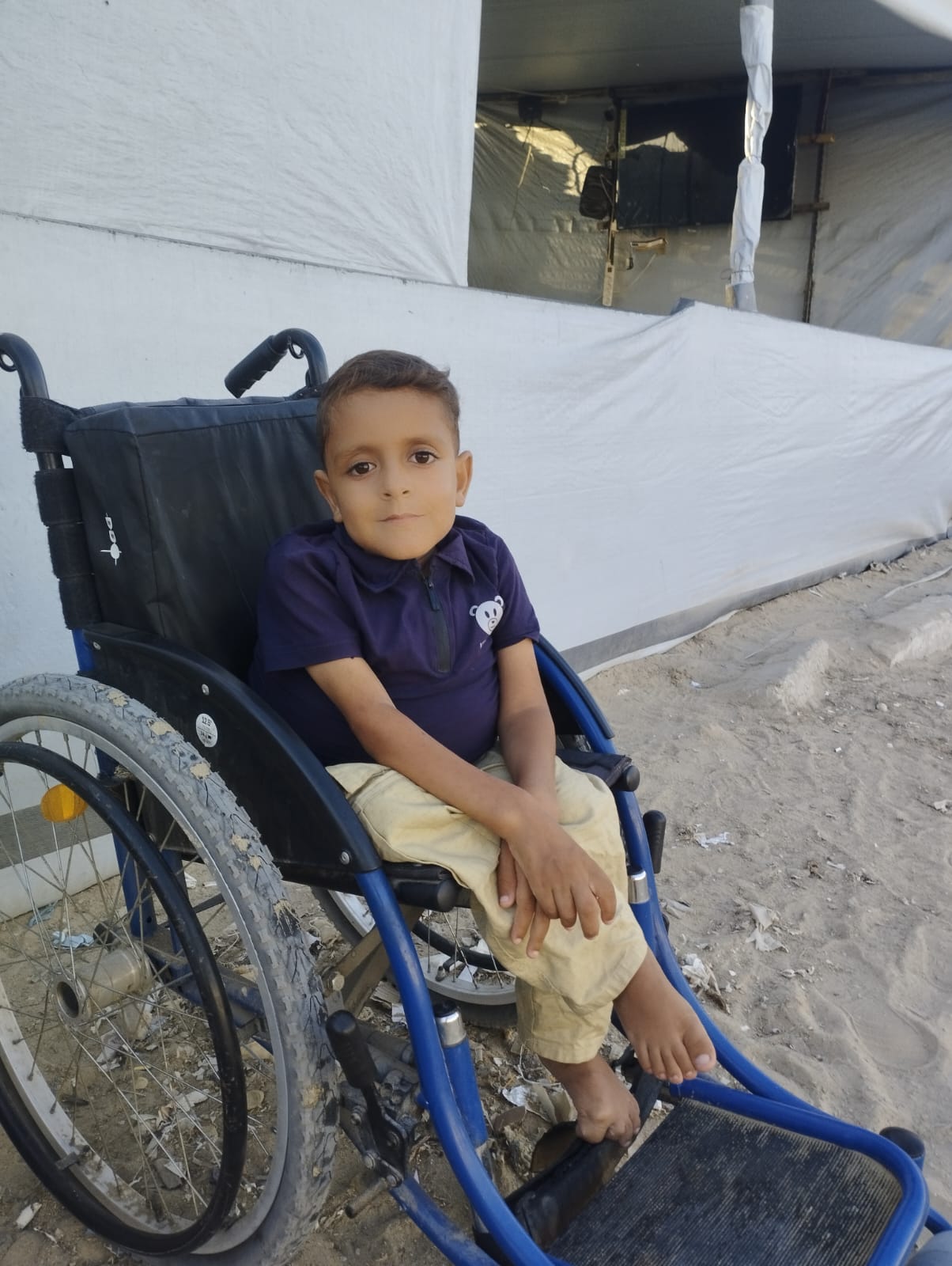 Murad Jarghoun, de 11 años, que sufre una enfermedad renal aguda, frente a la tienda de campaña en la que vive con su familia en el sur de Gaza, el 28 de julio de 2025.