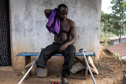 Sheku Turay descansa después de subir la montaña hasta su casa en Freetown. Sheku tiene una prótesis en la pierna, pero no puede usarla en los caminos y senderos accidentados para llegar a su casa. 
Solo tenía 12 años cuando los rebeldes atacaron su pueblo, en el distrito norteño de Tonkolili, durante la guerra civil que dejó decenas de miles de muertos entre 1991 y 2002. 
Los médicos sacrificaron su pierna para salvarla de la gangrena.  Como muchos otros, ha encontrado un apoyo muy necesario y una nueva oportunidad en la vida a través de su equipo de futbolistas amputados.
 