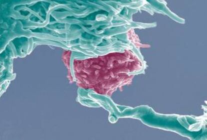 Las células T (en rosa) serán modificadas para atacar las células del cáncer mediante CRISPR.