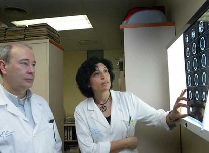 Joan Sahuquillo y Maria Antònia Poca, neurocirujanos del hospital Vall d&#39;Hebrón.