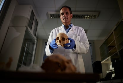 Jose Antonio Lorente muestra un cráneo de los restos óseos atribuidos a Cristóbal Colón