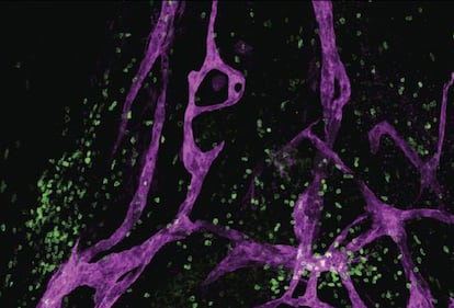 Um grupo de neurocientistas da Universidade de Virgínia (EUA) descobriu que o sistema linfático existe também no cérebro. Segundo os pesquisadores, a descoberta pode ter implicações importantes para doenças neurológicas graves como o autismo, a esclerose múltipla ou o alzheimer. Neste último caso, os pesquisadores assinalam que há de se ter em conta que na origem da doença está o acúmulo de grandes grupos de proteínas no cérebro. A partir de agora, propõem que é possível que isto aconteça porque esses vasos linfáticos não estão eliminando as proteínas de maneira adequada.