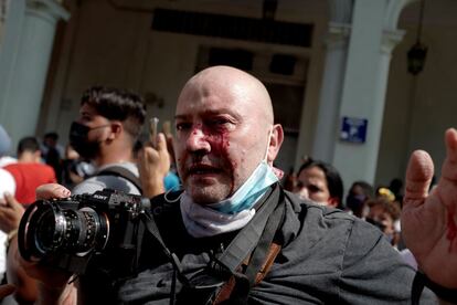 El fotógrafo español de la agencia de noticias Associated Press Ramón Espinosa fue agredido por agentes mientras cubría las protestas. Los detenidos por la policía fueron más de un centenar, pero no se disolvió la manifestación con gases lacrimógenos.