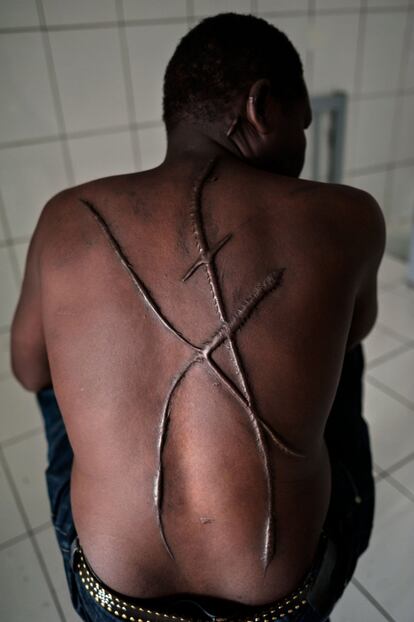 O sudanês Hassan Mekki carrega no corpo as marcas da violência e tenta refazer sua vida na Europa. A foto é de 2013, em Atenas