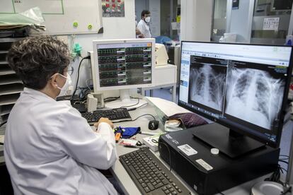 Una sanitaria repasa las radiografías de un paciente. Durante los ingresos se intenta evitar, si es posible, el traslado del paciente realizando las exploraciones necesarias, como por ejemplo radiografía y ecografía, con equipos portátiles en la habitación de aislamiento.