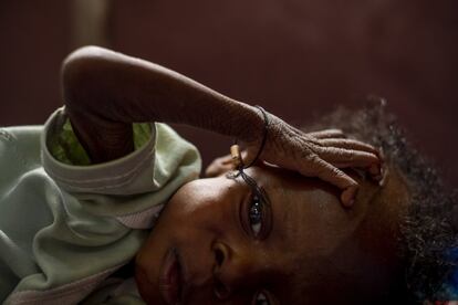 Esther Wandana tem nove meses de idade e sofre de desnutrição aguda severa, malária e HIV. Ela passou a maior parte de sua curta vida no Hospital Pediátrico do Unicef ​​em Bangui. Seu pai era um usuário de drogas. A mãe, Coue Natasha, 28, diz que quando engravidou de Esther, o marido foi embora e nunca mais voltou. Durante um teste de gravidez, ela descobriu que era HIV positiva.