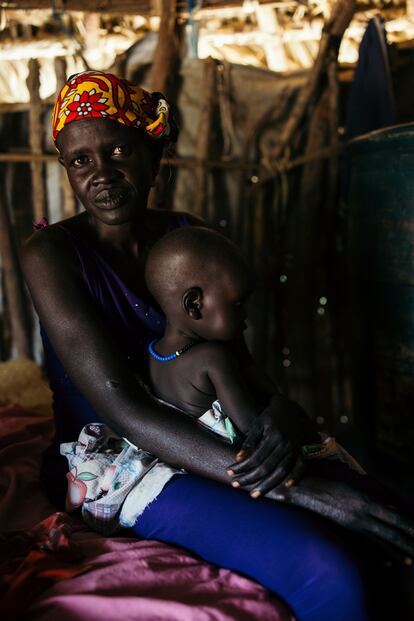 Ayen Chol Arem, de 40 años, sostiene a su hijo menor en la aldea de Panpandiar, en el Estado de Jonglei. Su hijo mayor contrajo meningitis de bebé y sufre una grave discapacidad, una hija nació con un pie zambo y otro hijo se rompió el fémur en una pelea y nunca recibió el tratamiento adecuado, lo que le ha causado problemas en su movilidad. “Por desgracia, no es infrecuente ver múltiples discapacidades debilitantes en un mismo hogar”, dice Daniel Anyang, jefe de equipo de Light for the World, quien subraya la vulnerabilidad de esta familia ante las inundaciones que afronta Sudán del Sur.