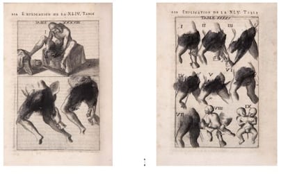 'L'arcenal de chirurgie' de Jean Scultet (Lyon, 1671).