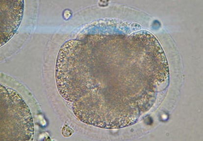 Imagen del supuesto embrin humano clonado, ofrecida por la empresa Clonaid.