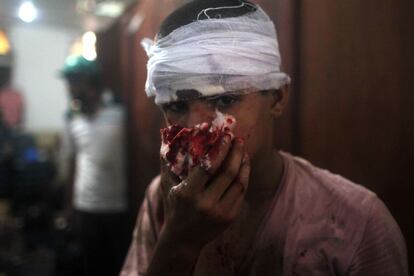 Un niño herido, en el hospital tras los enfrentamientos en El Cairo con la policía.