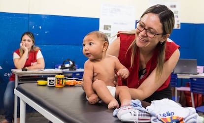 Bebé con microcefalia causada por el virus zika en Brasil. La microcefalia es una malformación congénita incapacitante.