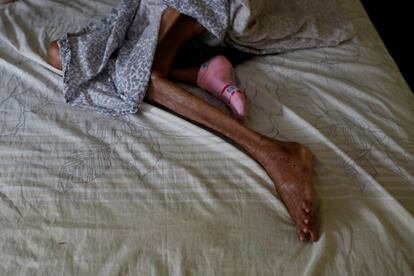 Las piernas desnutridas de Sibilina Caro, una anciana de Maracaibo, capital de Zulia, descansan en una cama en casa de su hija, Judith Palmar. 