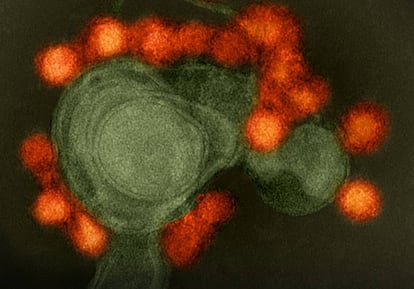 Imagen por microscopio electrónico del virus del Zika (en rojo) atacando la membrana celular.