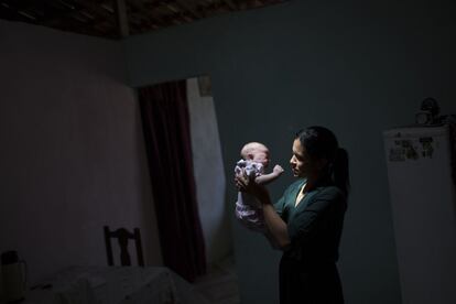 Uma mãe segura a filha, que nasceu com microcefalia, na Paraíba.